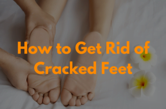 How to Get Rid of Cracked Feet