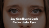 How to Get Rid of Dark Circles Under Eyes-Unveiling Radiant in 2025