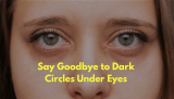 How to Get Rid of Dark Circles Under Eyes-Unveiling Radiant in 2023