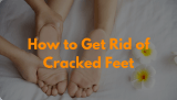 How to Get Rid of Cracked Feet: Effective Ways to Restore Your Feet